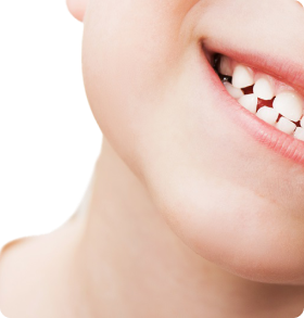Close-up of a smile with veneers on teeth