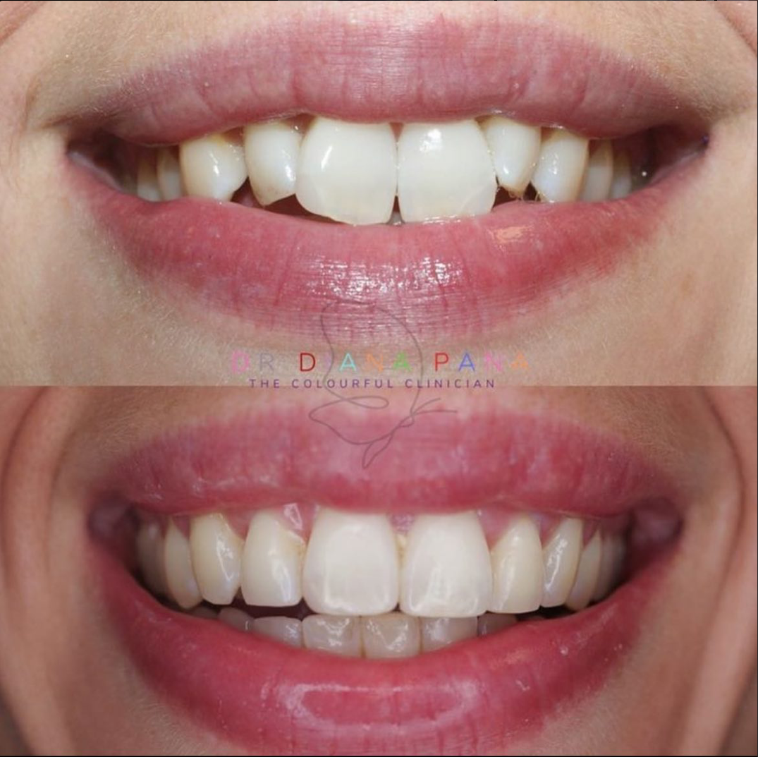 before and after dental treatment patient comparison