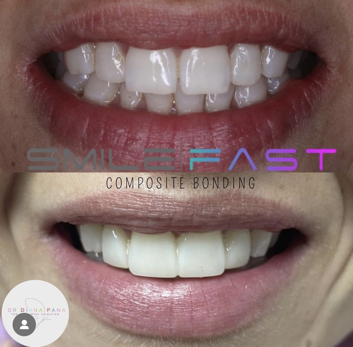 before and after dental treatment patient comparison