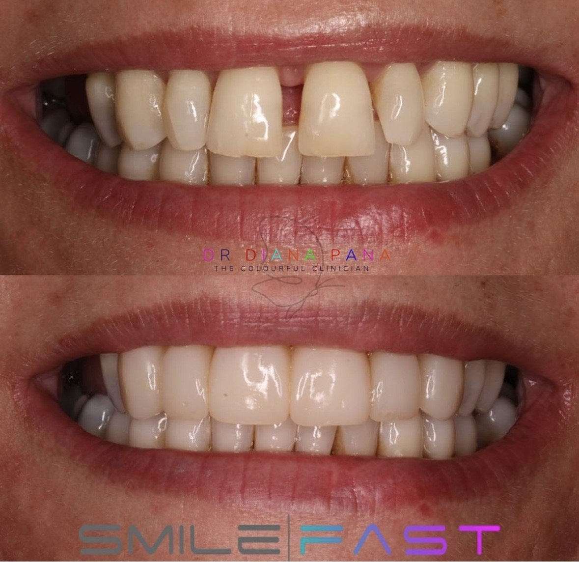 before and after dental treatment patient comparison