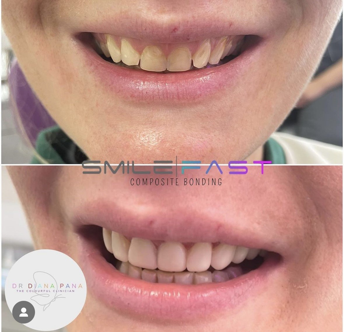 before and after dental treatment patient comparison