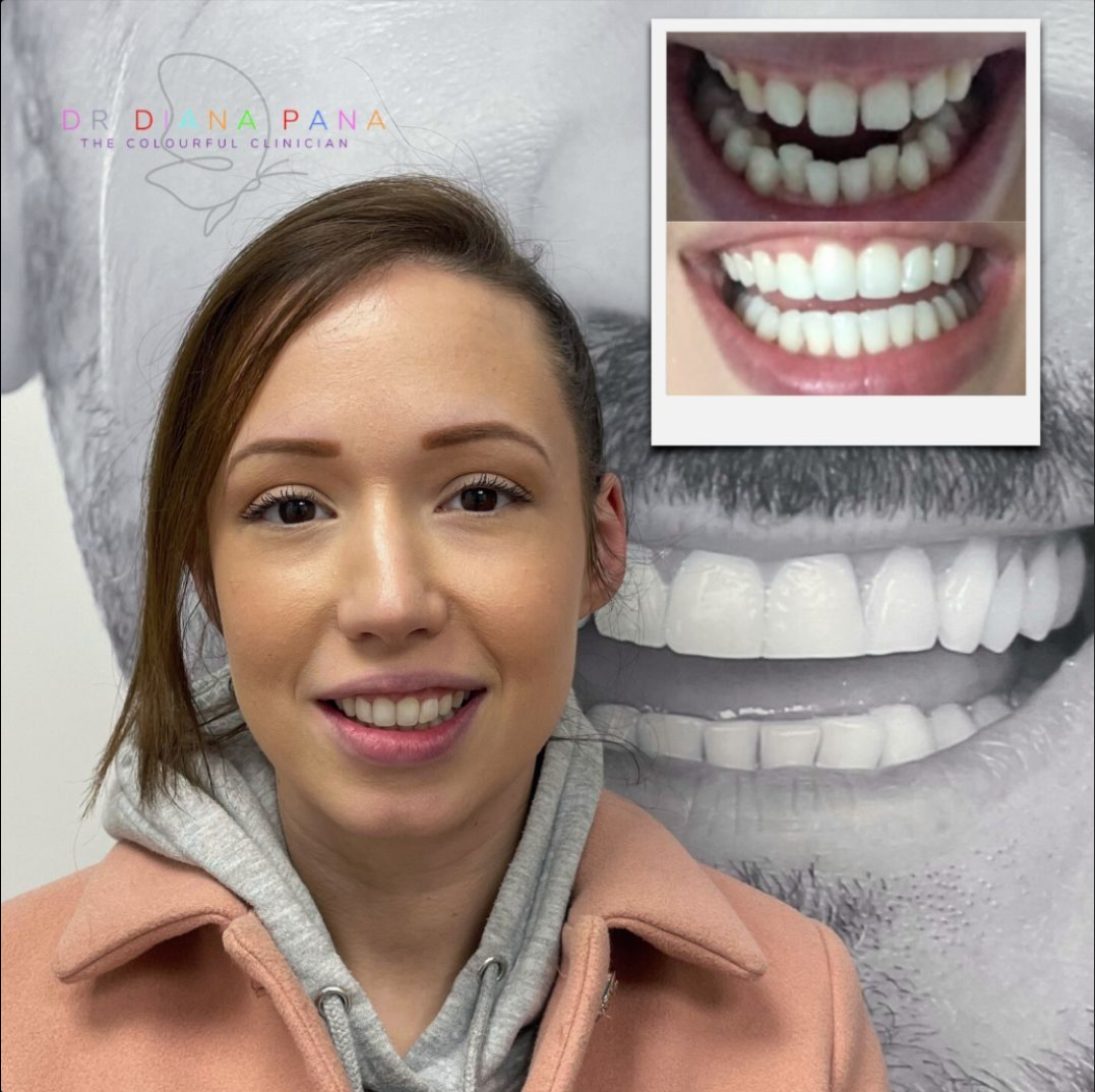 before and after dental treatment patient comparison