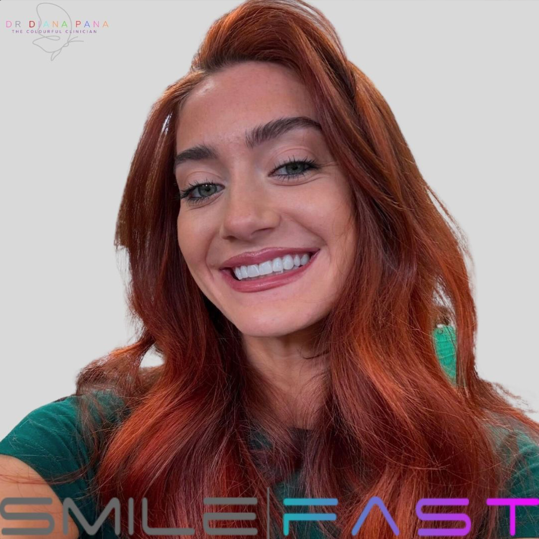 before and after dental treatment patient comparison