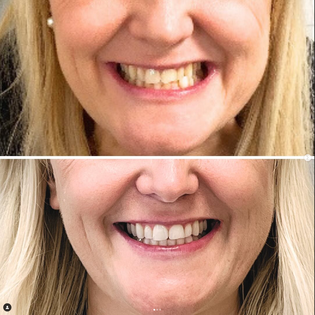 before and after dental treatment patient comparison